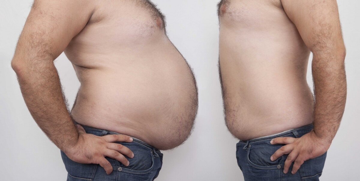 nutukę ir negali numesti svorio padidinti jėgos riebalų nuostolius