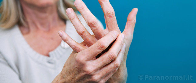 reumatoidinis artritas negali numesti svorio 40 kg svorio prieš ir po vyro