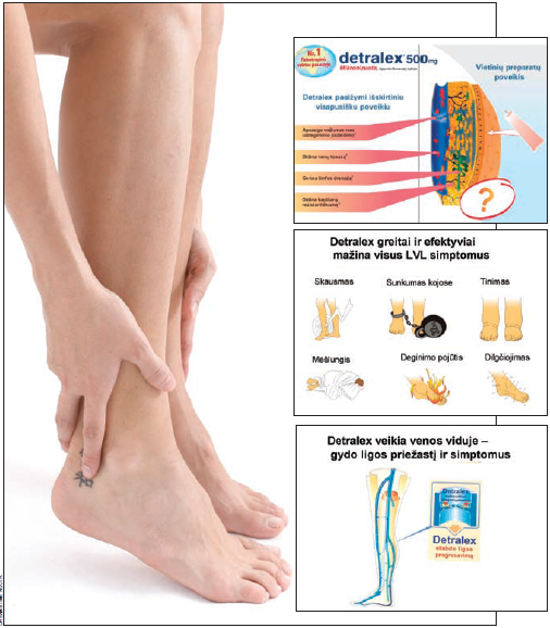 svorio metimas kojos patinimas riebalų deginimo greitintuvo injekcija