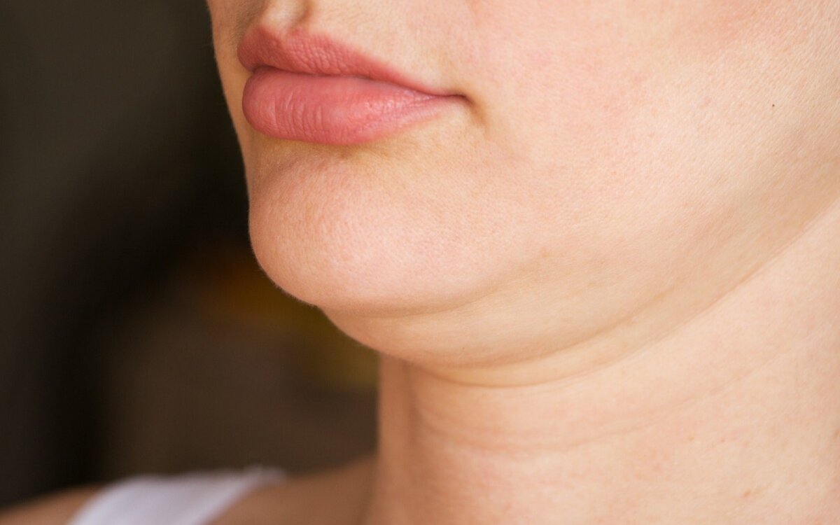 kaip išvengti veido riebalų praradimo kaip ms pacientai gali numesti svorį