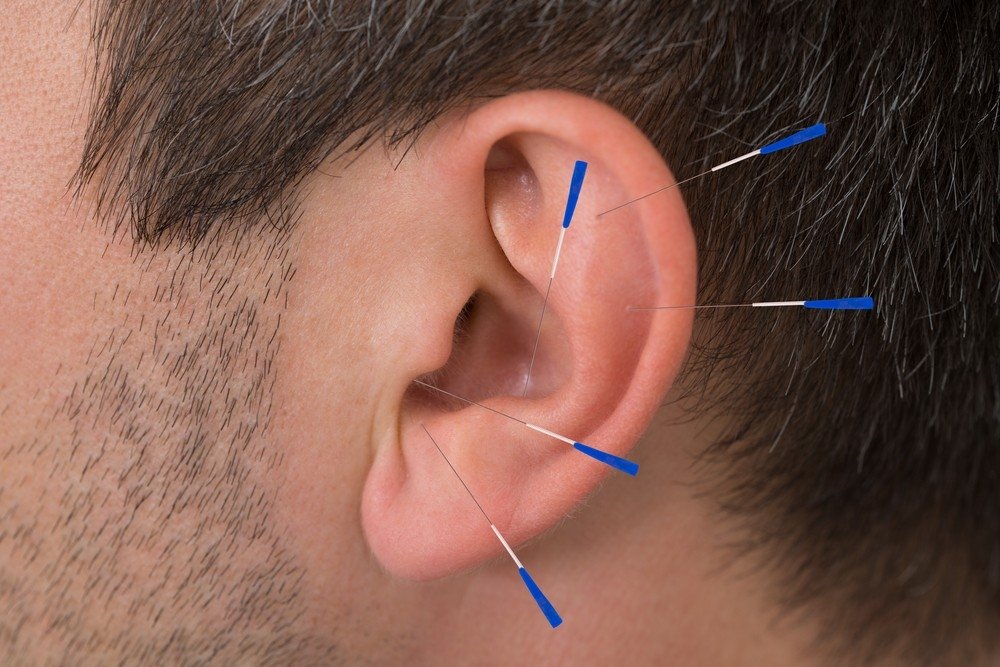 ausų auskarai kurie padeda numesti svorį