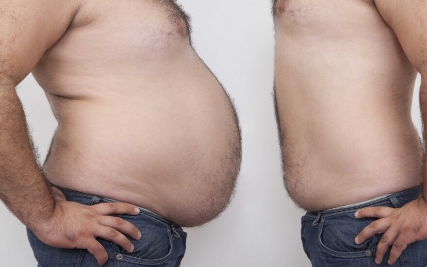 vyrų svorio metimo sėkmės istorijos 2021 m zach g svorio kritimas